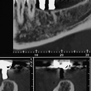 ハートフルにわの歯科医院 インプラントCT撮影