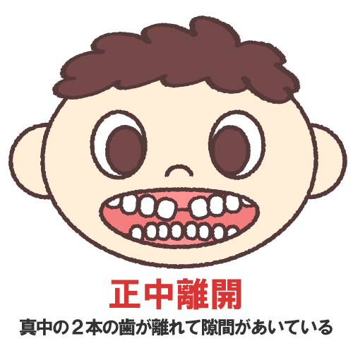 正中離開